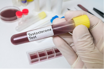 Health Risks Different for Men and Women with Genetically High Testosterone